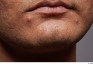HD Face Skin Ithamar Jung chin face lips mouth skin…